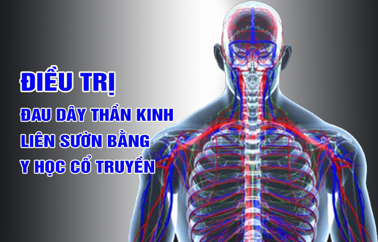 Điều trị đau dây thần kinh liên sườn (hiếp thống) bằng Y học cổ truyền